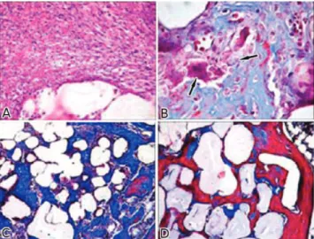 Figure 3 - Histology of tibias implanted with PLLA/PEO that were A) vancomycin-loaded or B) vancomycin-unloaded after 4 weeks, showing thin trabecular bone (arrow); and PLLA/PEO that were C) vancomycin-loaded or D) vancomycin-unloaded during a  32-week per