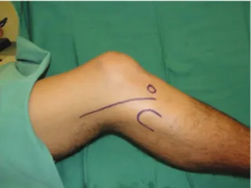 Figure 1 - Surgical access.
