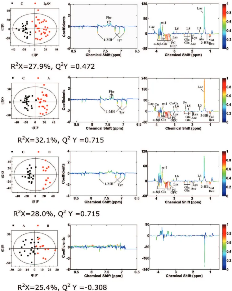 Figure 4 - OPLS-DA score plots (left panel) derived from 1 H NMR spectra of serum and corresponding coefficient loading plots (middle and right panels) obtained from different groups