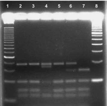 Figure 1 - The gel electrophoresis banding patterns used to genotype amplified DNA of study subjects digested with the HhaI restriction enzyme were as follows: (Column 1) 50-basepair DNA ladder; (Column 4) APOE2,3 genotype; (Column 5) APOE3,3 genotype; (Co