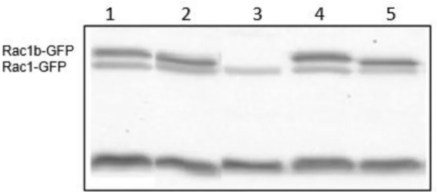Figure III.3 - RAC1/1b protein expression in Nthy-ori 3-1 transfected cells. 