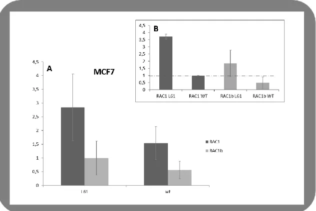 Figure III.6 - Regulation of NIS expression by RAC1 and RAC1b in MCF-7 cells A and B, effects of RAC1 and  RAC1b (both L61 and WT) on NIS expression