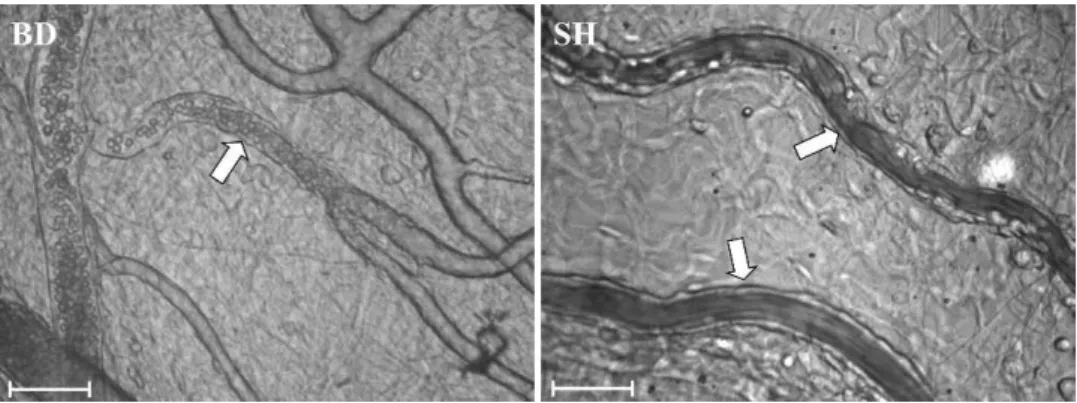 Figure 2 - Photomicrographs of rat mesenteric microvessels. The arrows indicate post-capillary venules in brain-dead (BD) and sham- sham-operated (SH) animals