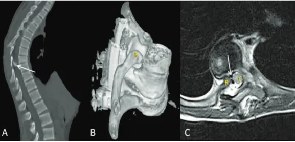 Table 2 - Comparison of pre-and post-operative radiology measurements.