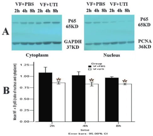 Figure 3 - UTI attenuated the translocation of NF-kB p65 from the cytoplasm to the nucleus