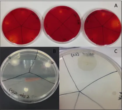 Figure 3.2.1: Detection of lipase production in plate assays. Two strains, Yarrowia lipolytica and Candida  sp., were used as positive controls