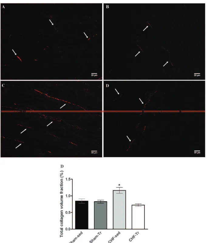 Figure 4 - Representative picrosirius red-stained ventricular sections under polarized light