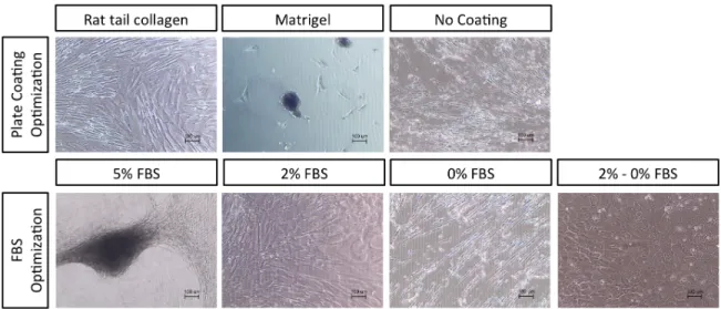 Figure   1.   Morphology   of   differentiated   UCX ®    resultant   from   Reference   Protocol   with   different   plate   coatings   (rat   tail    collagen,   Matrigel   ®,   without   coating)   and   FBS   concentrations   (5%   ,   2%,   0%   and 