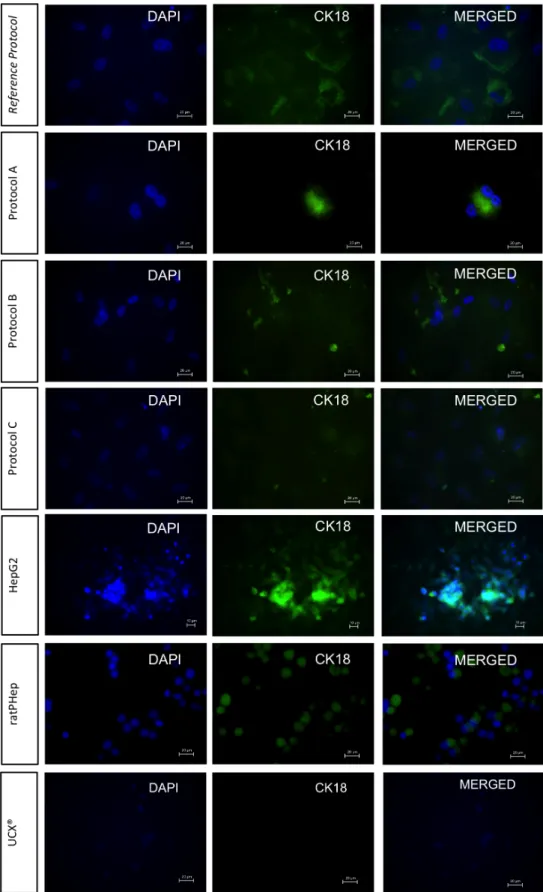 Figure    6.    Presence    of    CK18    in    differentiated    UCX®    at    day    24,    in    undifferentiated    UCX®(negative    control),    ratPHep    (one    day    after    isolation)    and    HepG2    (positive    controls)    in    2D    cul