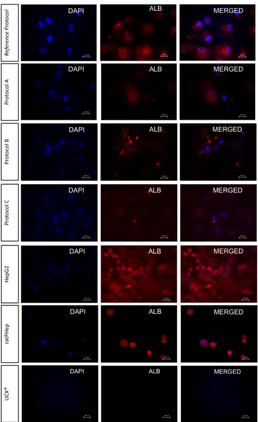 Figure    7.    Presence    of    ALB    in    differentiated    UCX®    at    day    24,    in    undifferentiated    UCX®(negative    control),    ratPHep    (one    day    after    isolation)    and    HepG2    (positive    controls)    in    2D    cult