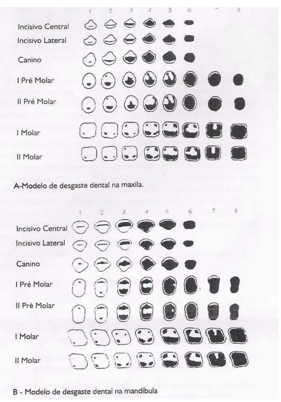 Figura 16: Classificação esquemática (A e B) do desgaste dental  Fonte: MURPHY, 1959 