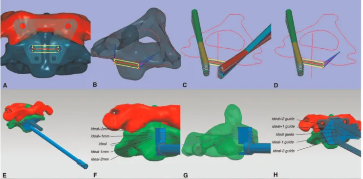 Figure 4 - A diagram showing the digital and realistic templates.