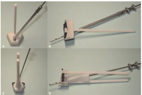 Figure 6 - A diagram showing the comparison between the planned and inserted screw trajectories