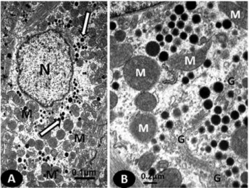 Table 2 - Morphometric indexes of the cardiomyocyte cytoplasm and nucleus in the RA of sham and OVX mice.