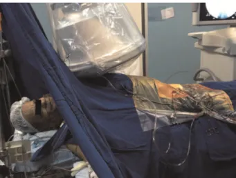 Figure 1 - Image shows an awake patient being treated for a ruptured aneurysm under local anesthesia.