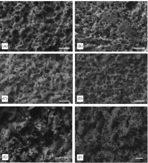 Fig. 2. Scanning electron micrographs showing microstructure in cheeses produced from non-refrigerated milk in two different dairies [A (A, B) and B (C, D, E, F)] and ripened for 60 d (A, C) and 180 d (B, D) (scale bar ¼ 20 mm), showing distribution of mic