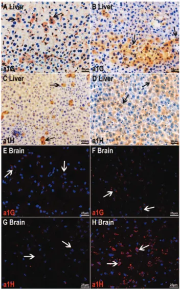 Figure 4 - Western blot analysis of T-type Ca 2+ channel expression in liver and brain tissues of diabetic and nondiabetic mice.