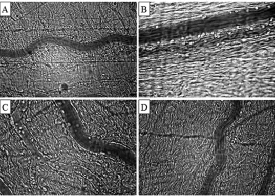Figure 3 - Representative photomicrographs of the mesenteric microcirculation of a sham-operated rat (A); a control, non-treated rat (B); a lactated Ringer’s solution-treated rat (C); and a Ringer’s ethyl pyruvate solution-treated rat (D)