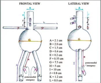 Figure 3 - Procedures for testing the Hourglass endograft in the in vitro model of juxtarenal aneurysm: (1) proximal deployment of the endograft; (2) RA catheterization; (3) final photographic image of the in vitro experiment; (4) final fluoroscopic image 
