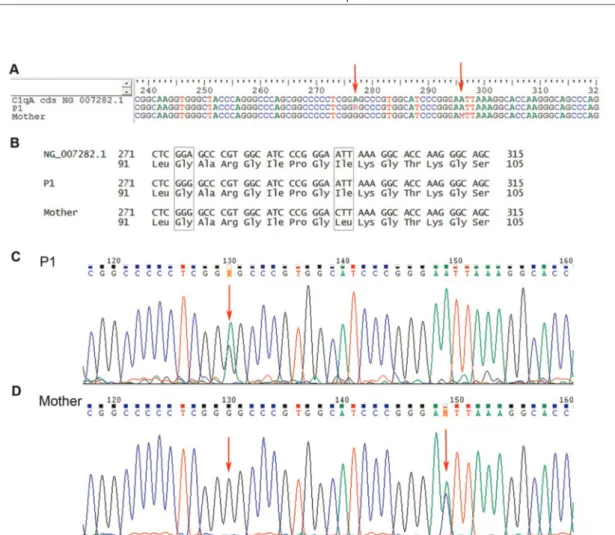 Figure 1 - C1qA gene sequencing from juvenile systemic lupus erythematosus patient 1 (P1) and P1’s mother