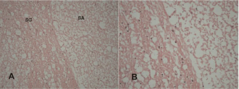 Figure 3 - A) Histopathological features of the spinal cords of rabbits with healthy cells in the substantia grisea (SG) and a mild level of vacuolization in the substantia alba (SA) (H&amp;E, 2006 )