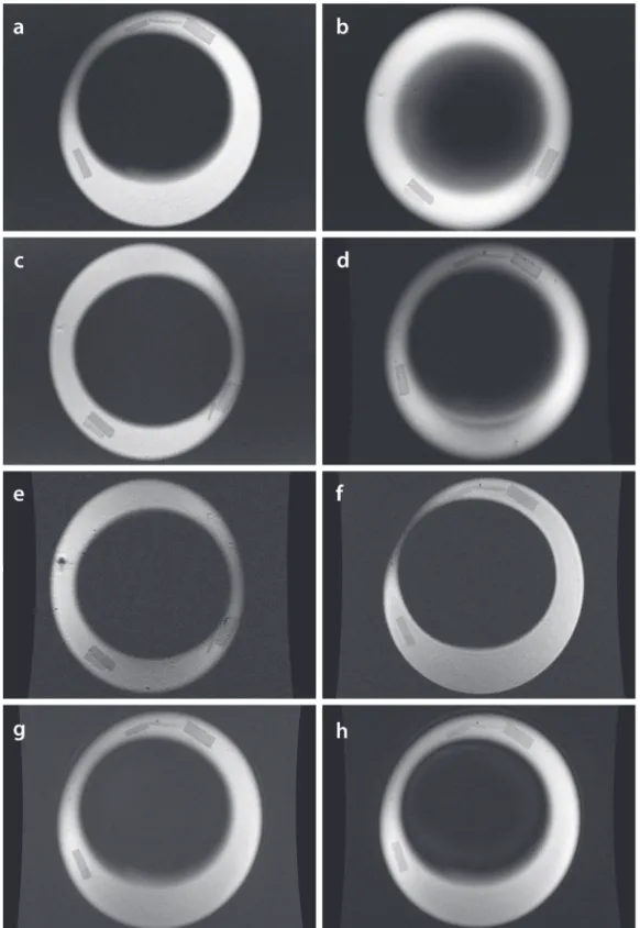 Figure 2 - Coronal MR images generated by various sequences and parameters.