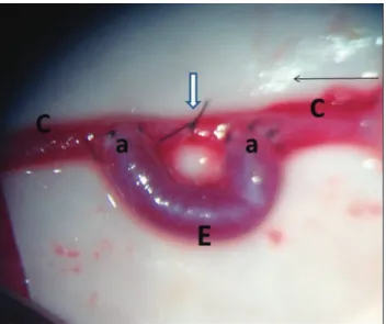 Figure 1 - Final aspect of the surgical procedure. C – left carotid;