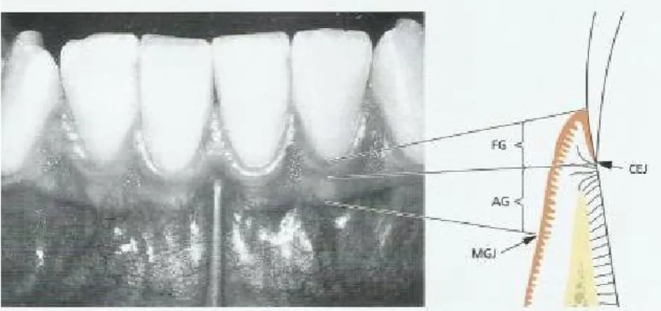 Figura  1.  Tipos  de  gengiva  -  gengiva  livre  (FG),  gengiva  inserida  (AG),  junção  cemento-esmalte  (CEJ)  e  junção mucogengival (MGJ) 17 .