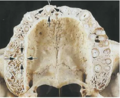 Figura 3. Corte transversal feito através do processo alveolar da maxila no nível da porção média das raízes  dentárias  17 .