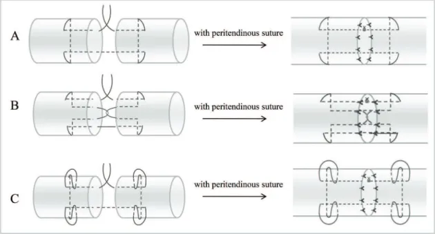 Figure 1 - Various suture techniques used for mechanical testing. A. Modified Kessler suture with peritendinous suture (MK);