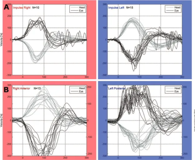 Table 2 - CT hypofunction compared with abnormal gain in the vHIT. Presence of caloric hypofunction Absence of caloric hypofunction Abnormal vHIT 16 25 41 Normal vHIT 8 108 116 24 133