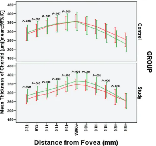 Figure 2 - Mean macular choroidal thickness measurements from each group at different locations across a horizontal section through the fovea