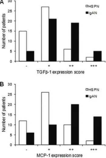 Table 6 - Correlation between the tubulointerstitial fibrosis grade and TGF-b1 expression in HSPN.