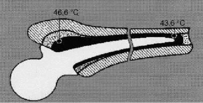 Figura 3.6: A temperatura máxima in vivo do cimento ortopédico durante o final do  endurecimento
