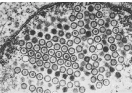 Figura 2. Vírions HSV dentro do núcleo de uma célula infectada. A membrana nuclear  aparece no canto superior esquerdo da figura