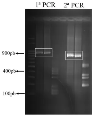 Figura 3.3: Eletroforese de 5´UTR de MCDV-BR. Análise do produto de PCR em gel  de agarose 1% mostrando os fragmentos amplificados da região 5´UTR via a técnica de  5´RACE