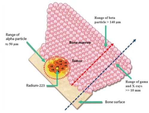 Figure  1.6  –  Bone-targeted  localized  mechanisms  of  action  of  the  α-emitter  isotope  223 Ra  comparing  treatment area ranges to other ionising radiation (β particles, X-rays and gamma radiation)