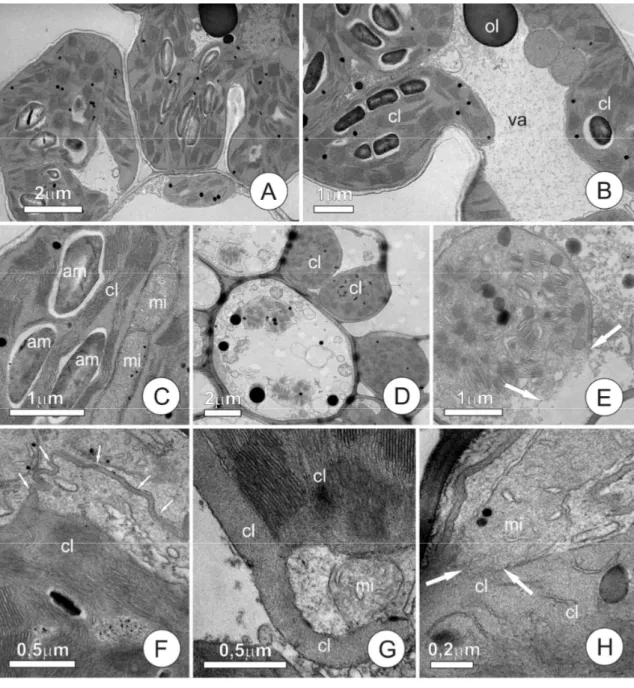 Figura  4  A-H.  Aspectos  ultraestruturais  do  mesofilo  de  Oryza  sativa  L.,  cultivado em solução com 160µM Al com raízes intactas