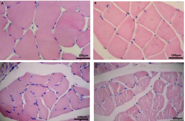 Fig. 7 - Fotomicrografia do músculo gastrocnêmio corado em HE: (A). Controle, sem  lesões  aparentes;  (B,  C  e  D)  Grupos  imobilizados  aos  15,  30  e  45  dias, 