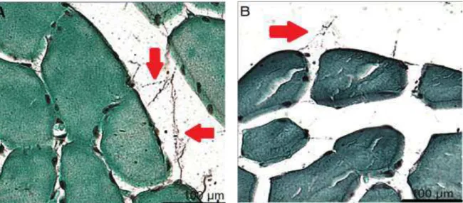 Fig. 13.  Imagem digitalizada das células musculares do sóleo e gastrocnêmio  com  marcação  positiva  para  Caspase  3  (núcleos  em  apoptose  ou  em  autofagocitose)