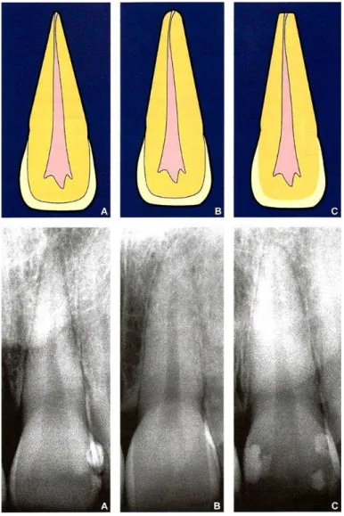 Figura 4:  Forma geométrica das raízes dentárias. 