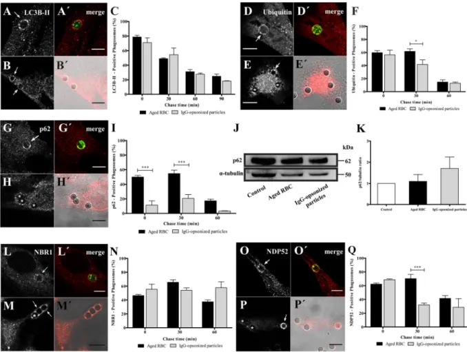 Figure 1.  Acquisition of LC3B-II and autophagy adaptor proteins by phagosomes in non-professional  phagocytes