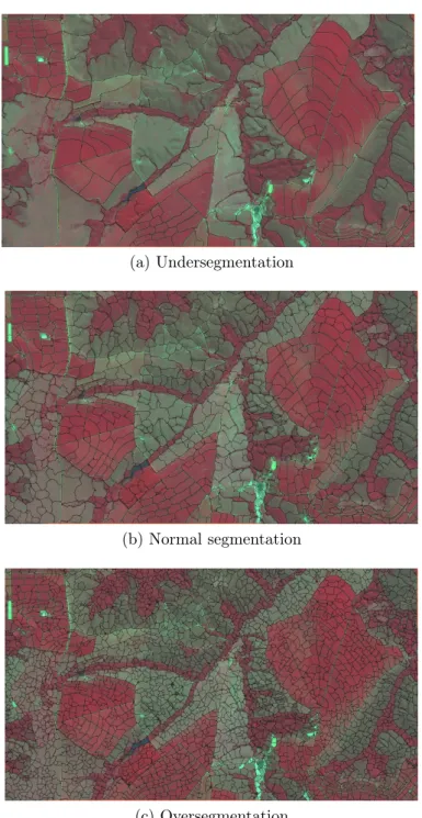 Figure 2.4: Segmentation examples using the IFT-Watersheed at three different levels: (a) undersegmentation (b) normal segmentation (c) oversegmentation.
