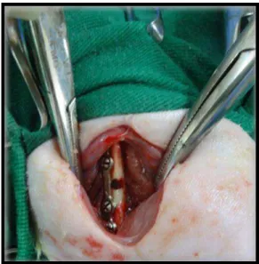 Fig. 1: Foto do procedimento cirúrgico realizado  no  fêmur  esquerdo  de  ratos  Wistar