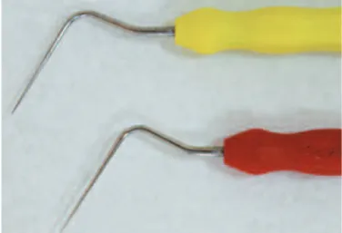 Figure 15 – Hand instruments as spreaders with long cables were developed to allow working without blocking the visibility.
