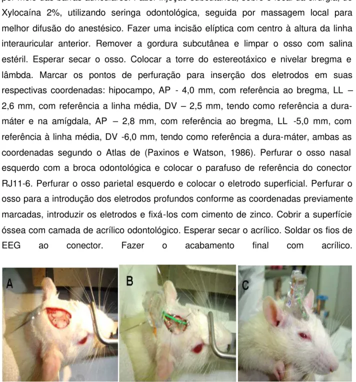 Fig. 1- Etapas do procedimento de implantação dos eletrodos superficial e profundo, (ver  descrição do procedimento no texto)