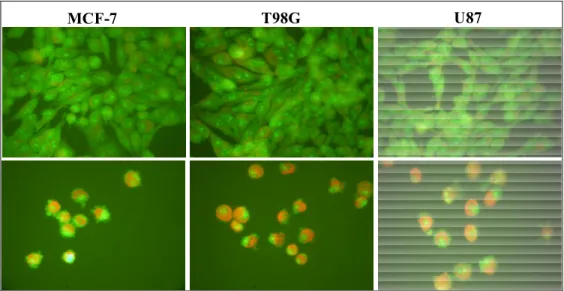 Figura 3.3.4. Fotografia obtida em microscópio de fluorescência de células MCF-7, T98G e U87 controle  (acima) e tratadas com 2 (1 μmol L -1