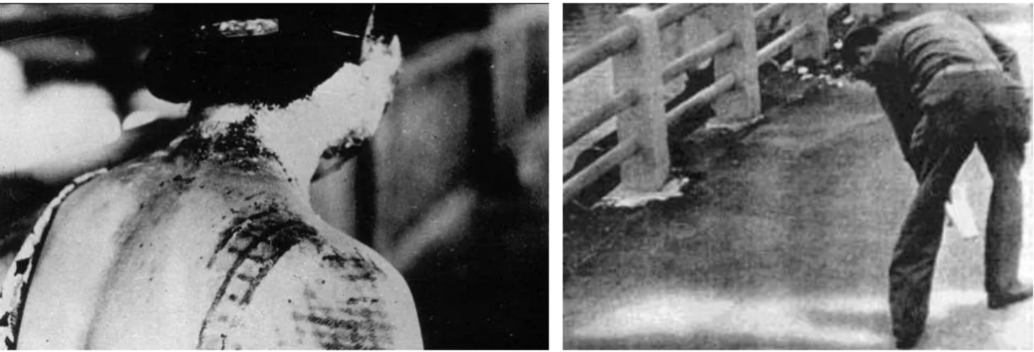 Figura 22 - Impressões sobre a pele e sobre o asfalto, após ação da bomba atômica em Hiroshima e Nagazaki