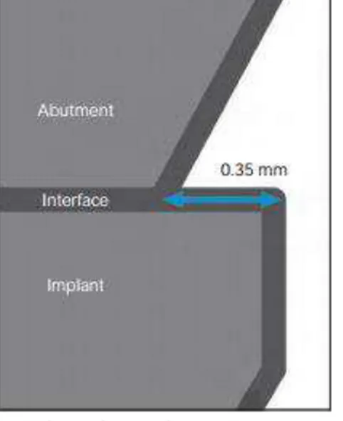 Figura 9 - Esquema da Plataforma trocada usando o exemplo de um implante  de diâmetro da plataforma 4.8 mm com um abutment de 4.1 mm