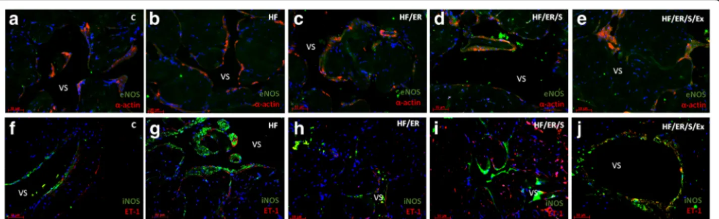 Fig. 1 Dual immunolabeling of eNOS/ α -actin (a-e) and iNOS/ET1 (f-j) in erectile tissue of rats from all experimental groups ( n = 3/group)